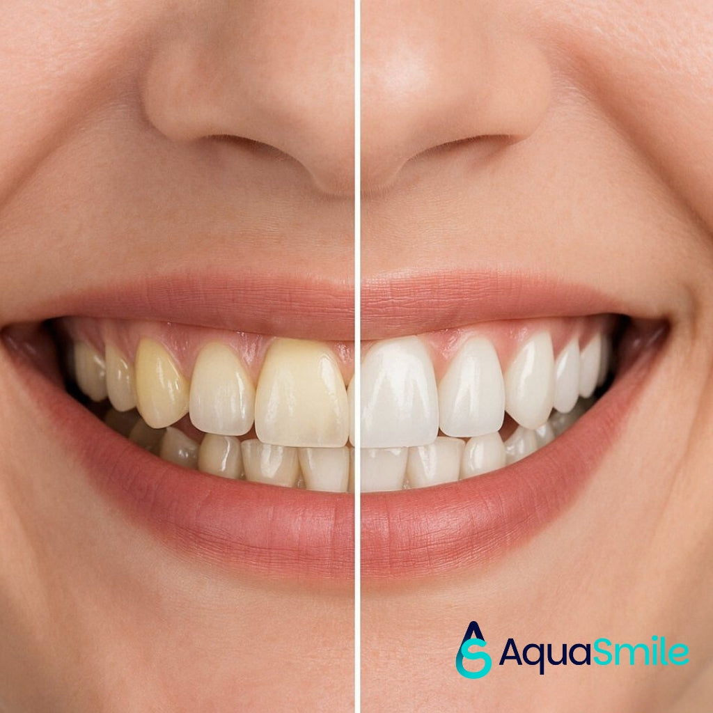 Kit Blanqueador Dental AquaSmile